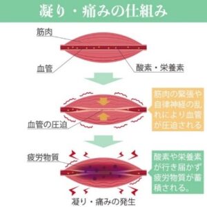 筋肉