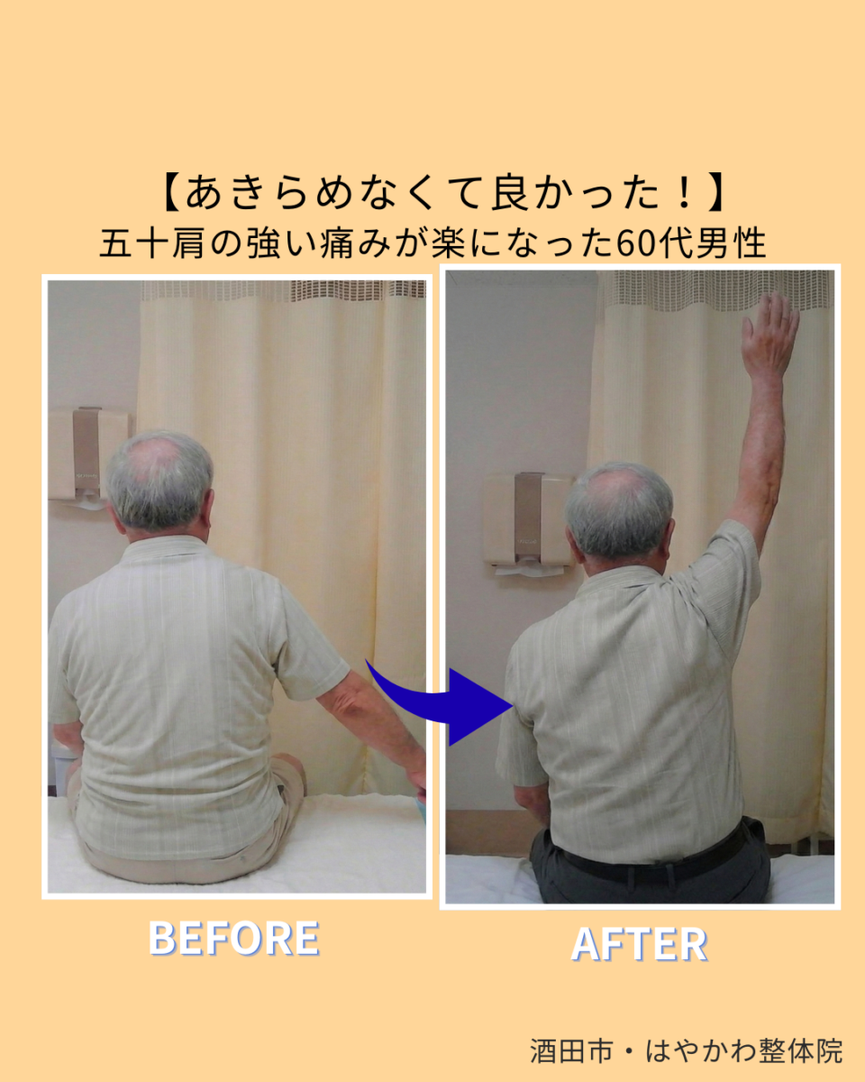 酒田市で四十肩・五十肩を根本改善【医師も推薦・口コミ最高評価の技術】